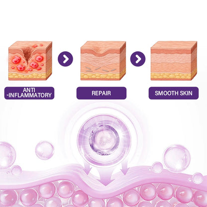 ReGenScar Stem Cell Scar Gel