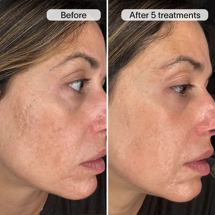 ReGenScar Stem Cell Scar Gel