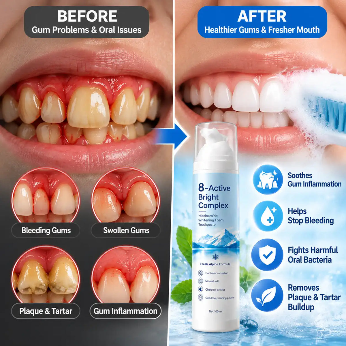 [Professional Grade] Niacinamide Foaming Toothpaste 8X