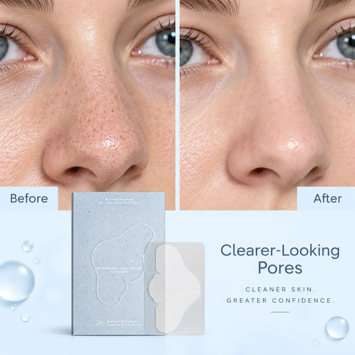 NOSE PATCHES